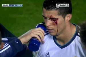 莱万特旧将:我过去曾无意肘击C罗,媒体却几乎要把我关进监狱 - 资讯配图