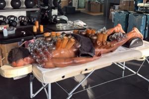 东方神秘力量!尤文前锋奥蓬达拔罐治疗,从脖子到小腿全是罐子 - 资讯配图