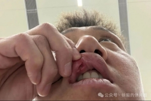 高迪赛后共缝九针:昨天蛮疼今天又是一条好汉,不想错过踢申花 - 资讯配图