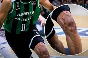 贾巴里·帕克膝盖近照：沟壑纵横 千疮百孔！曾遭两次ACL撕裂 - 资讯配图