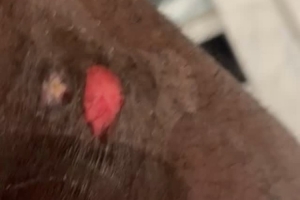 詹姆斯自拍展示右腿上的伤口：可能是年度最佳扑球造成的！好痛！ - 资讯配图