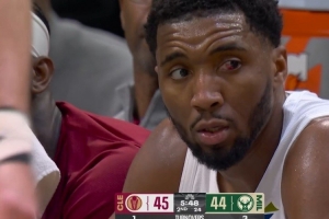 米切尔:我的左眼几乎看不见 得分能力不行想在其他方面帮助球队 - 资讯配图