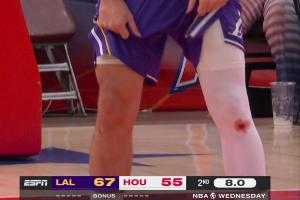 东契奇&库里膝盖出血之谜：不是药水 而是地板擦伤留下的真实血迹 - 资讯配图