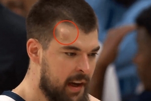 “头上有犄角！”祖巴茨防守时被克林根打出包 回更衣室&回归成疑 - 资讯配图