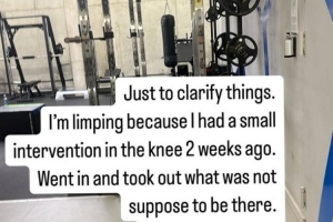 库卢社媒发文：一瘸一拐是因为膝盖进行了一次小手术，现在很好 - 资讯配图